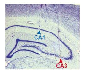 CA1 and CA3