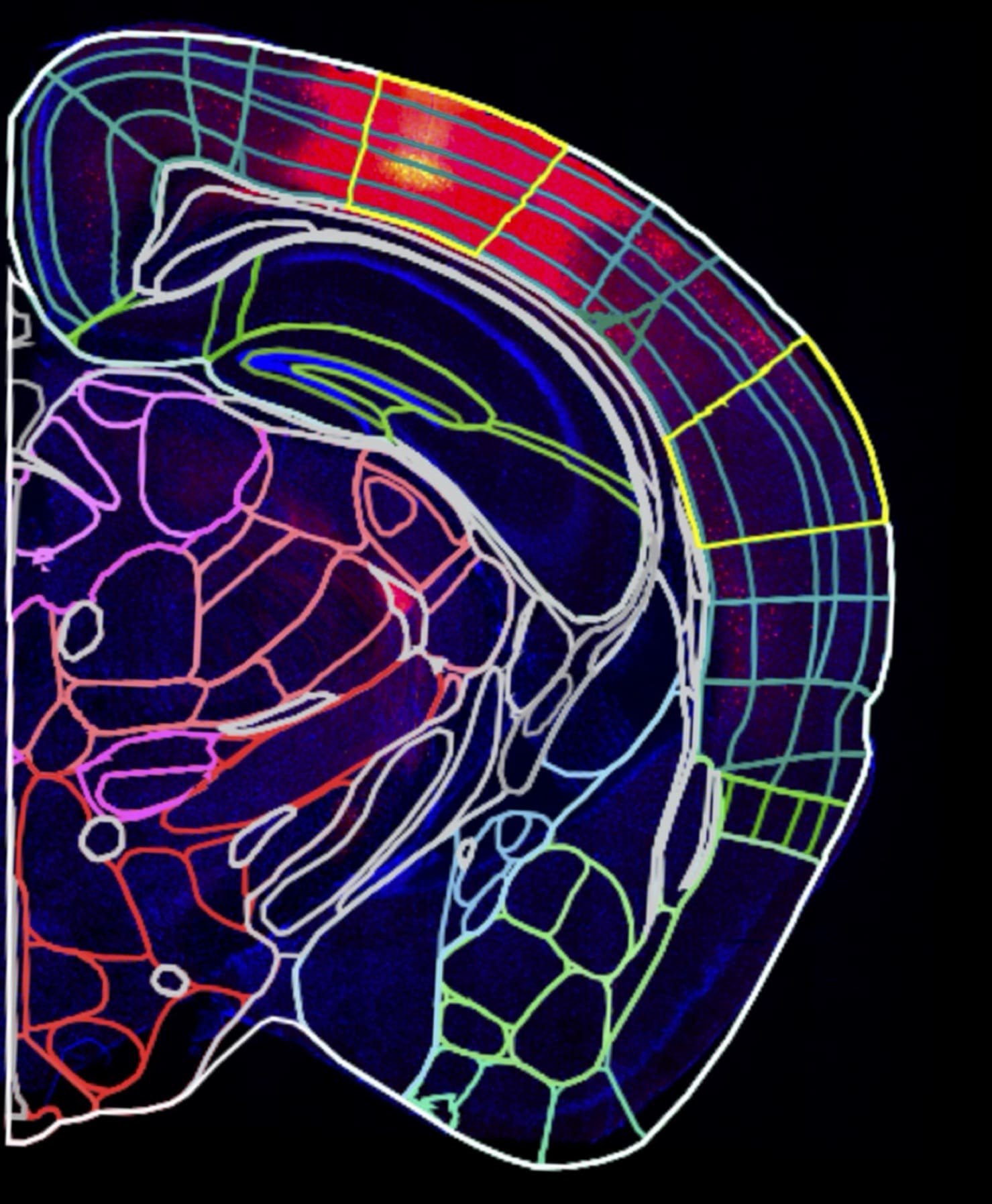 mouse brain coronal section