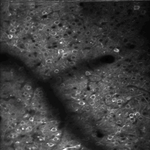 Two-photon image of cells showing GCaMP label in visual cortex