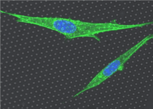 cells moving through a post array